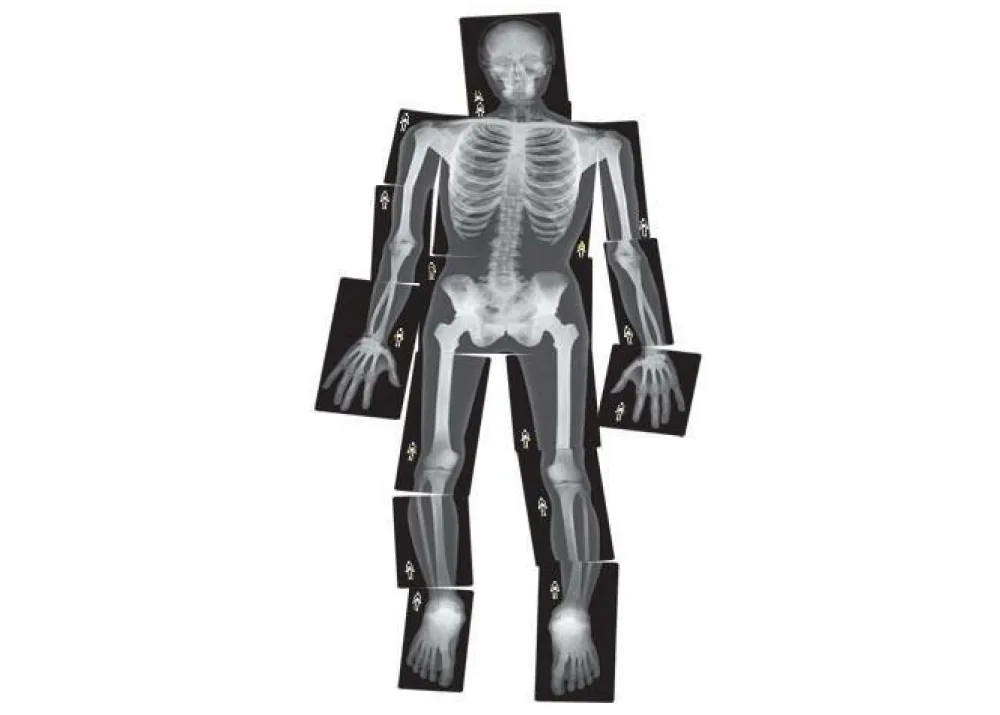 Lysborde|Halloween< Røntgenbilleder - Menneske, 18 stk